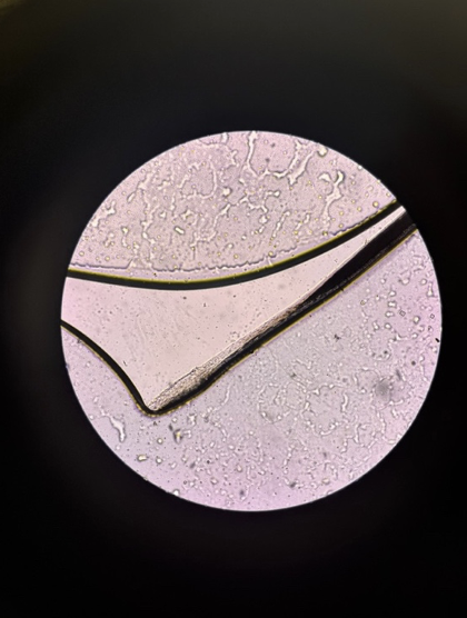Hair strand under microscope — single strand showing medulla and cortex