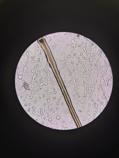 Multiple hair strands under microscope — showing structural comparison